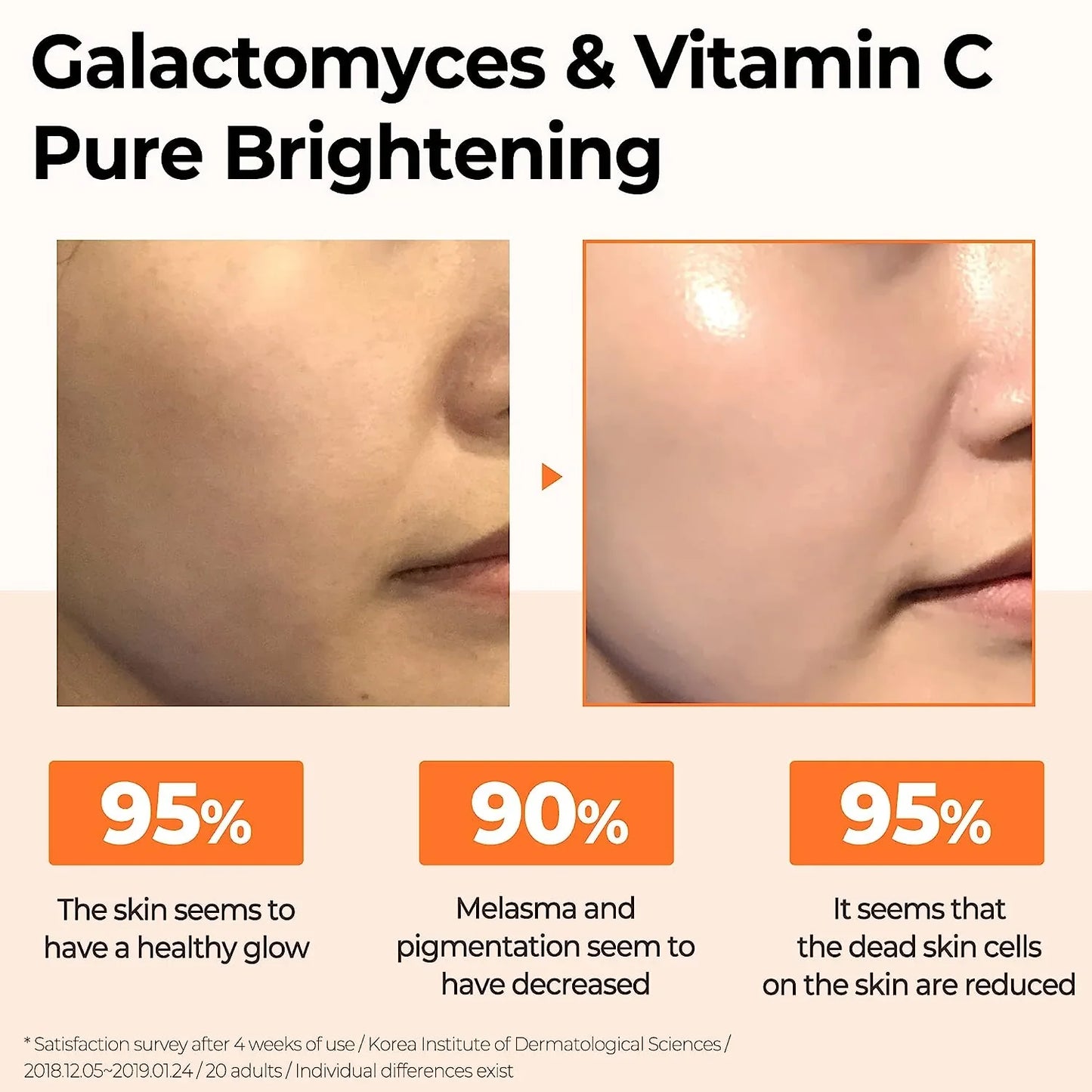 Some By Mi Galactomyces Pure Vitamin C Glow Serum -  Serum Προσώπου για Λάμψη με Βιταμίνη C και γαλακτομύκητα