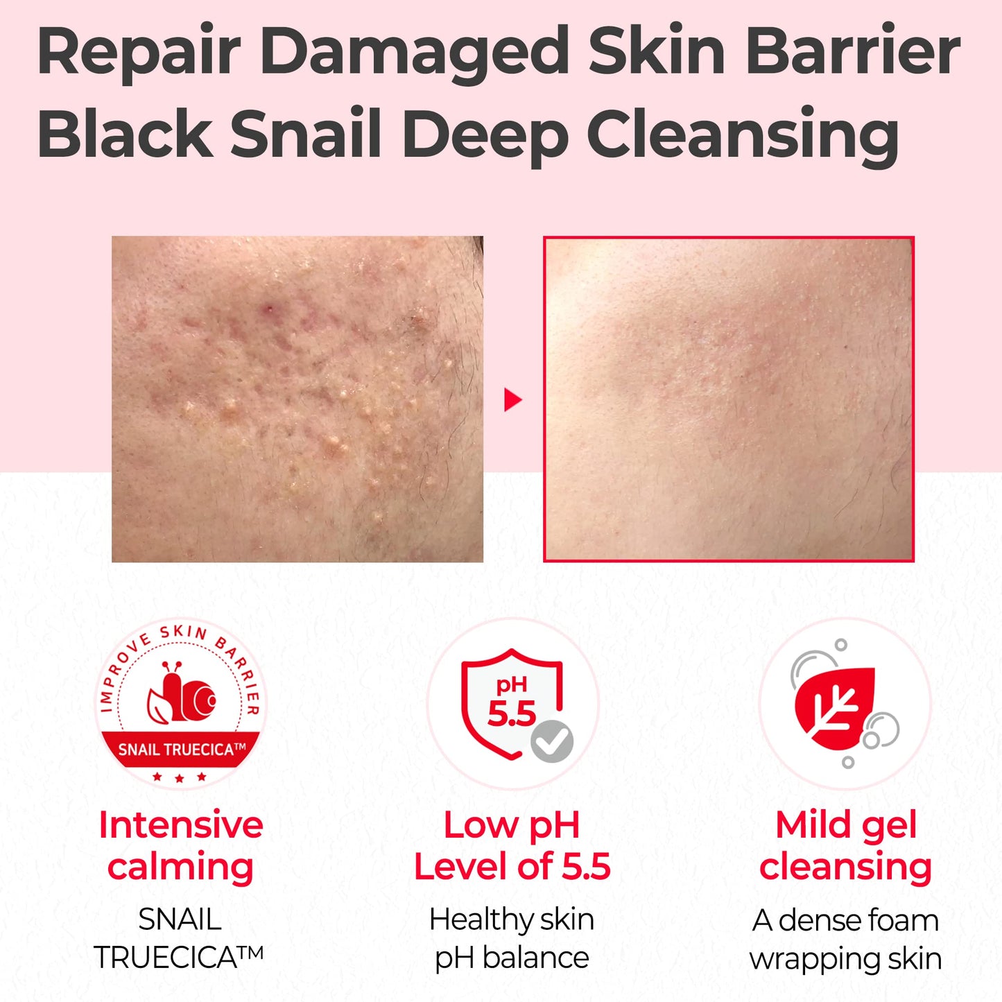 Some By Mi Snail TrueCICA Miracle Repair Low pH Gel Cleanser - Τζελ καθαρισμού προσώπου με χαμηλό pH