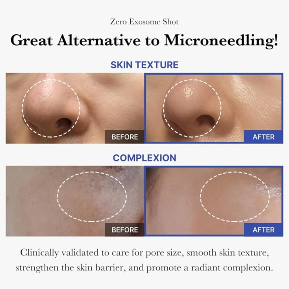 Medicube One Day Exosome Shot 2000 – Ορός με εξωσώματα και τεχνολογία microneedle