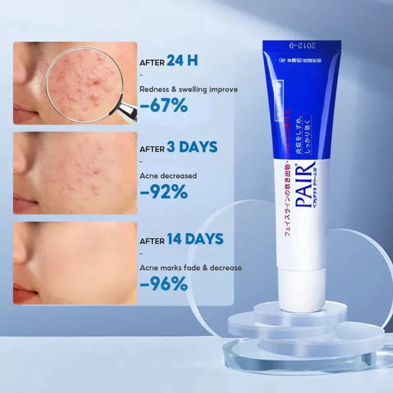 Lion Pair Acne Cream W - Κρέμα Προσώπου κατά της Ακμής & της Ερυθρότητας 24gr